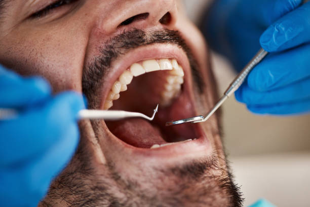 Best Pediatric Emergency Dentist in Neenah, WI